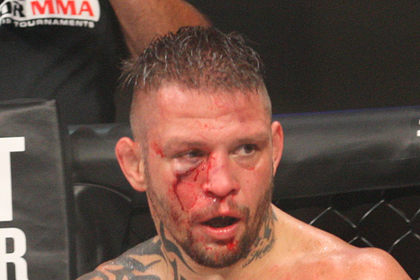 Как травмы повлияли на жизнь легендарного бойца UFC